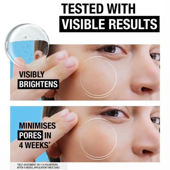 Neutrogena Hydro Boost 10% Niacinamide Serum 30ML