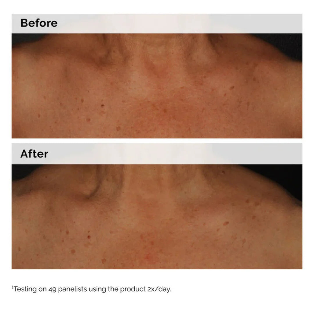 The Ordinary Niacinamide 5% Face And Body Emulsion For Dark Spots And Uneven Tone 100ML