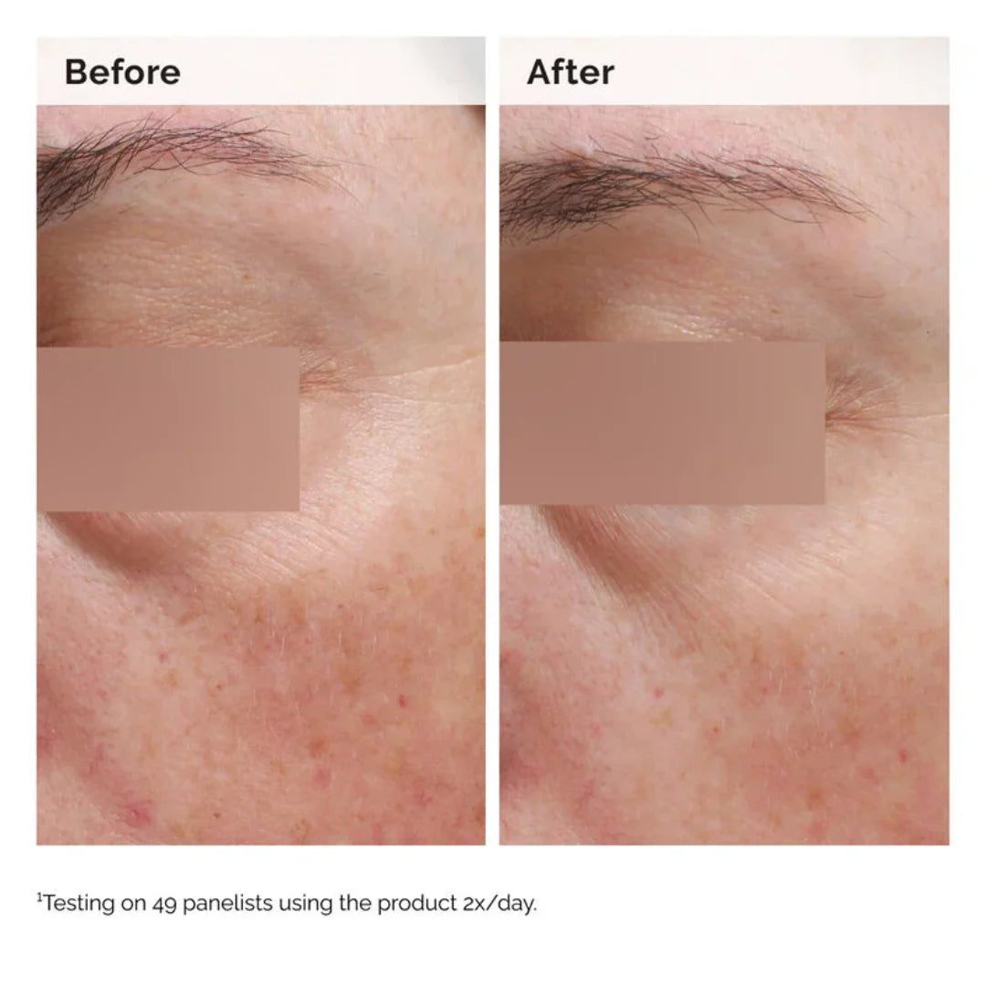 The Ordinary Niacinamide 5% Face And Body Emulsion For Dark Spots And Uneven Tone 100ML