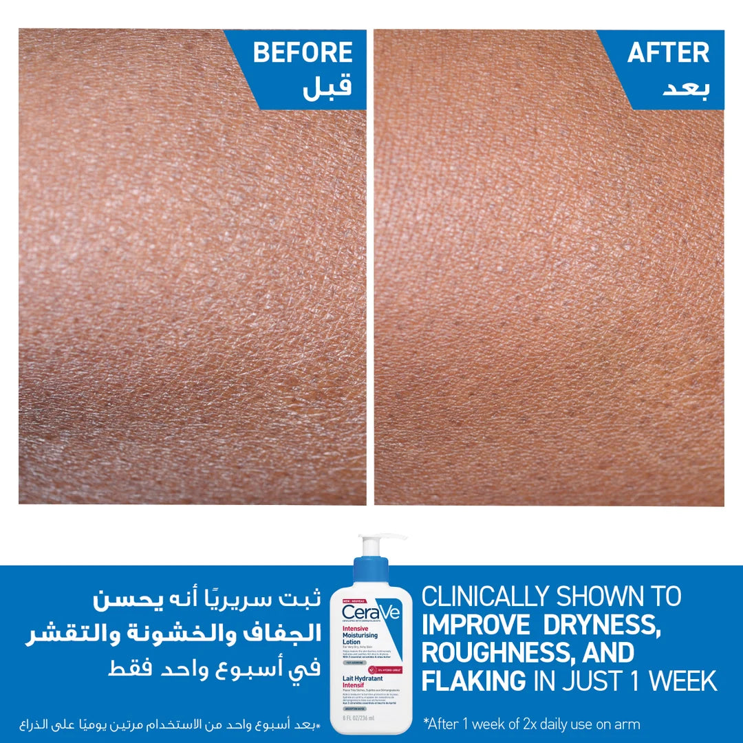 CERAVE INTENSIVE MOISTURISING LOTION FOR VERY DRY SKIN 236ML