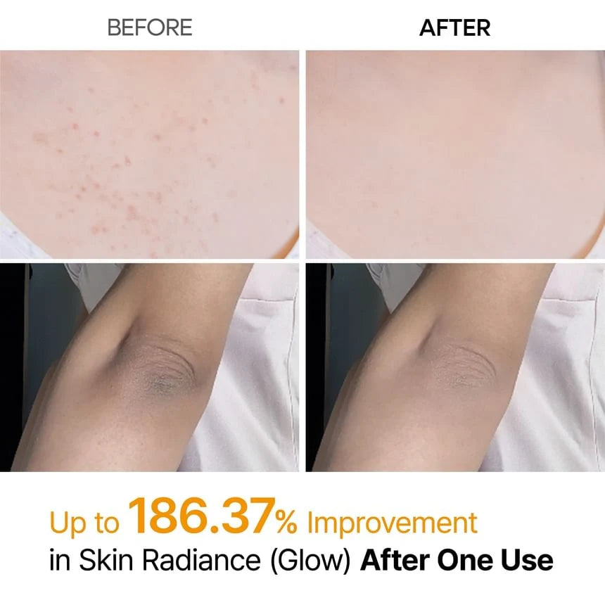 DR.MELAXIN PEEL SHOTEXFOLIATING KOJIC ACID TURMERIC SPRAY