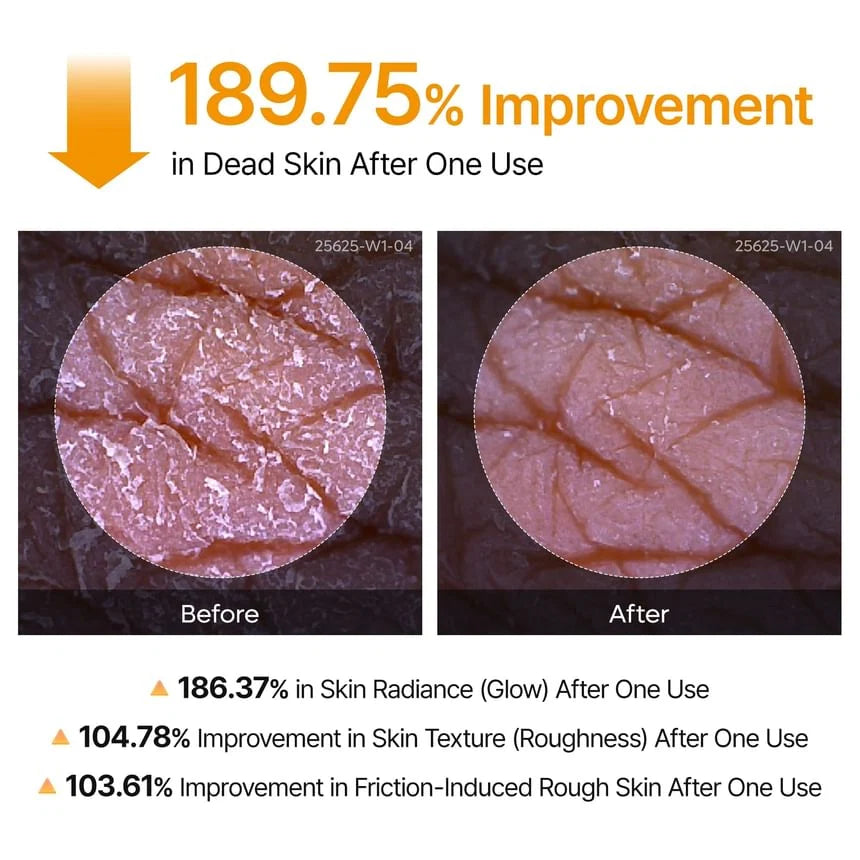 DR.MELAXIN PEEL SHOTEXFOLIATING KOJIC ACID TURMERIC SPRAY
