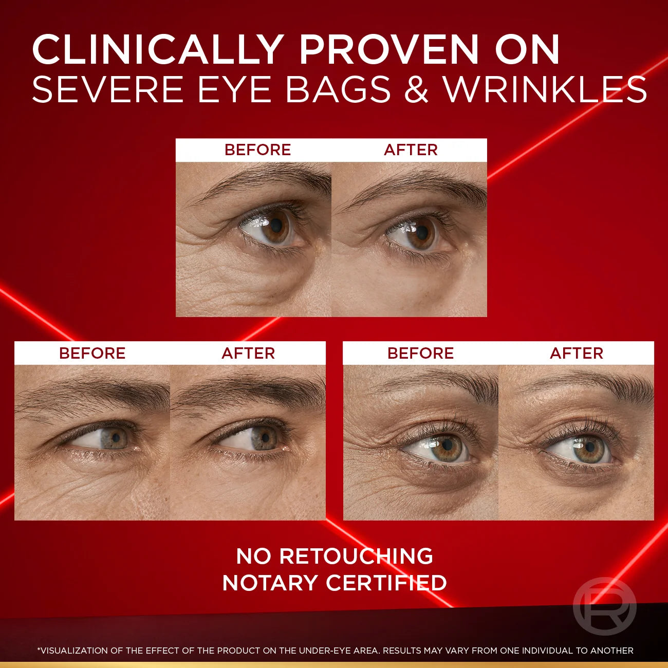 Loreal Revitalift Laser Instant Eye Bag Eraser 15ML