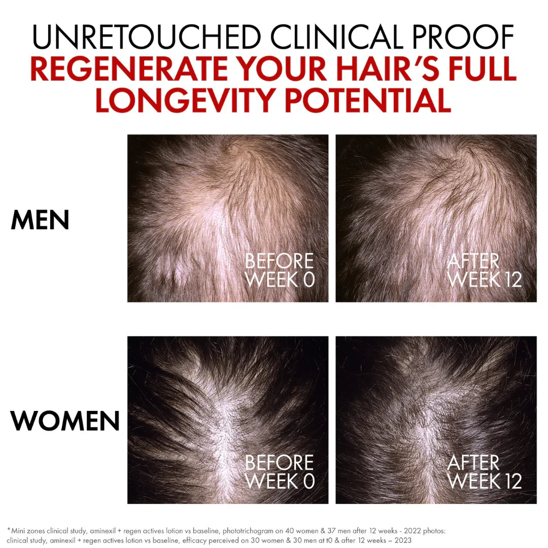 VICHY Aminexil Clinical R.E.G.E.N. Hair Renewing Serum 90ML