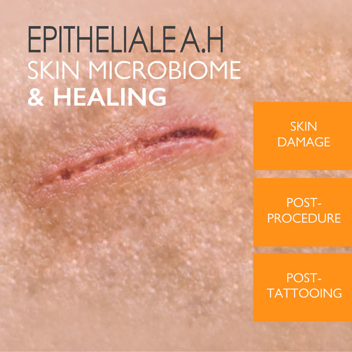 A-Derma Epitheliale AH Ultra Anti-mark Ultra Repairing Cream Buy 1 Get 1 FREE Bundle