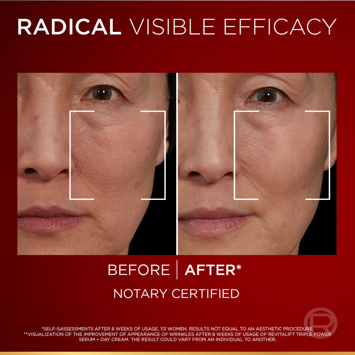 Loreal Revitalift Laser Triple Power Serum 30 ML