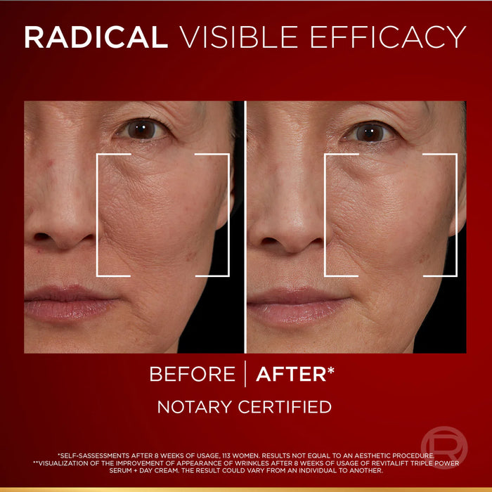 Loreal Revitalift Laser Triple Power Serum 30 ML