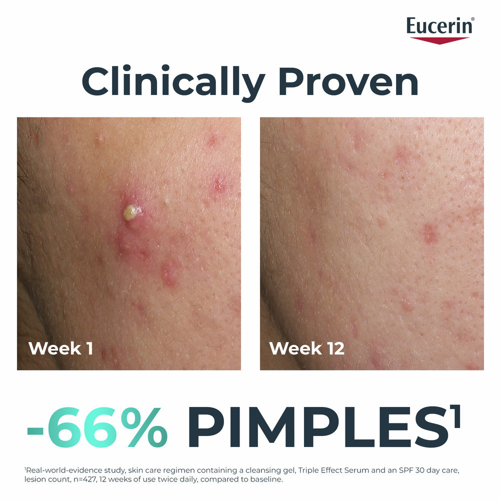 Eucerin DermoPure Clinical Triple Action  40ML